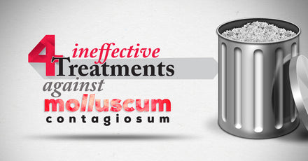 4 Treatments That Are Ineffective Against Molluscum Contagiosum