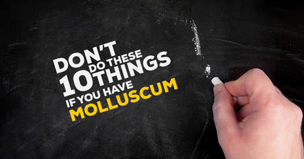 Don’t Do These 10 Things If You Have Molluscum Contagiosum
